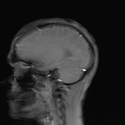 MRI scan of my brain, animated slice sequence