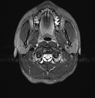 MRI scan of my brain, animated slice sequence